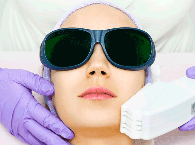 Tratamiento-facial-con-laser
